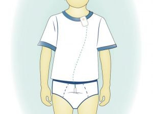 Zest Bedwetting Alarm