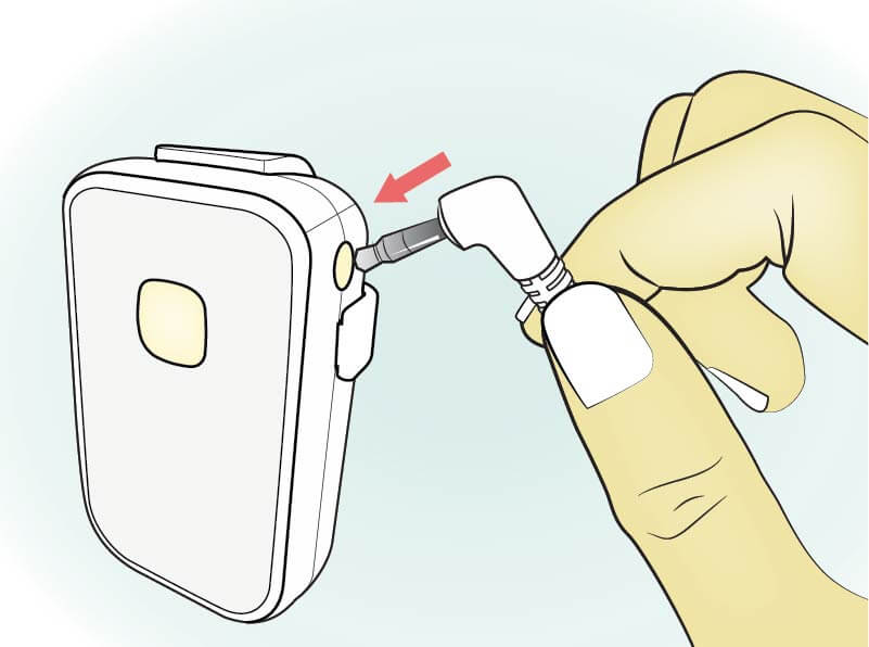 Zest Bedwetting Alarm Zest Bedwetting Alarm